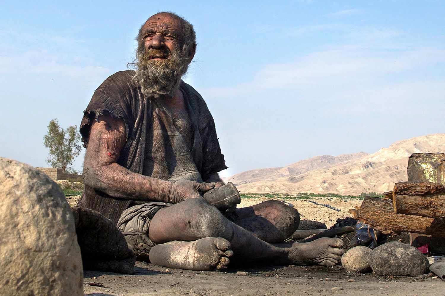 His first bath after 60 years led to his death.