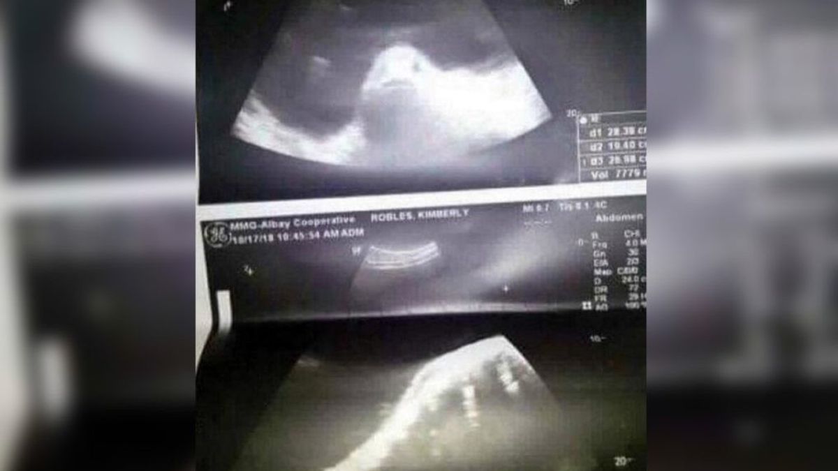 Got pregnant by fish