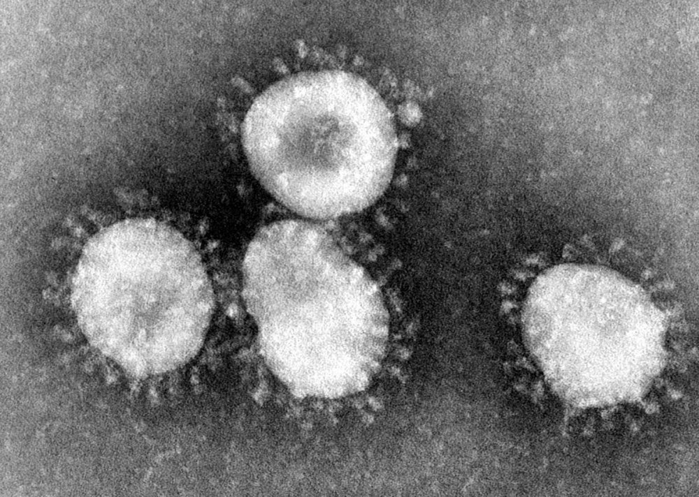 A Killer Deadly Flu