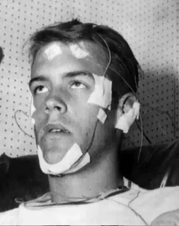 Gardner's achievement in staying awake for over 11 days remains a remarkable example of human resilience and scientific curiosity