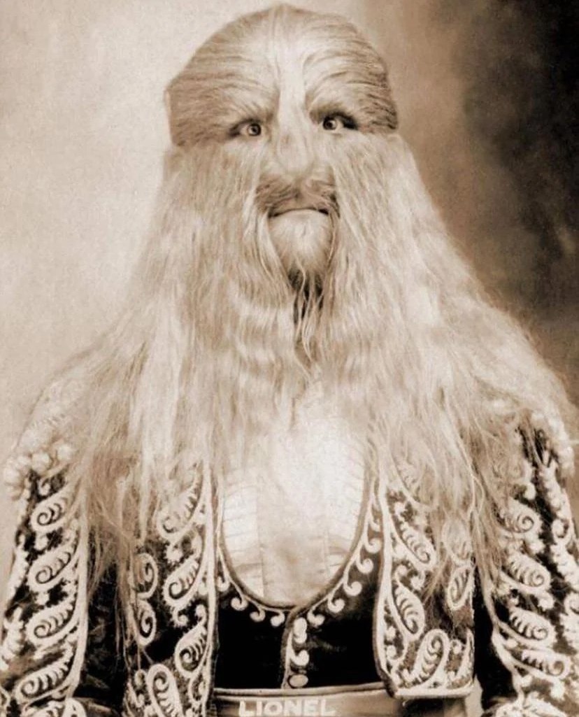 Lionel the Lion-Faced Man exemplifies resilience, acceptance, and the celebration of individuality in the face of adversity