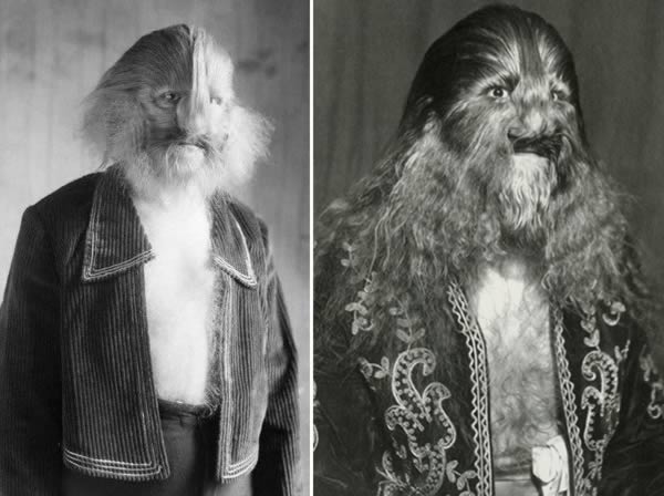Was a famous sideshow performer with a rare condition called hypertrichosis.